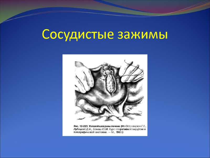 Сосудистые зажимы